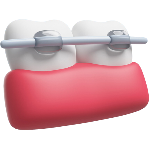 어린이부정교합치아보험